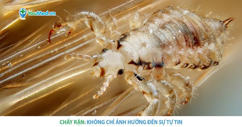 Mot nguoi tre tuoi dang duoc bac si kiem tra suc khoe tong quat truoc khi bat dau chuong trinh tap chay bo chuyen sau
